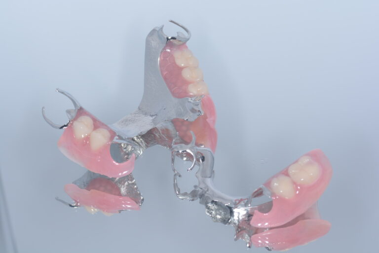 入れ歯治療について