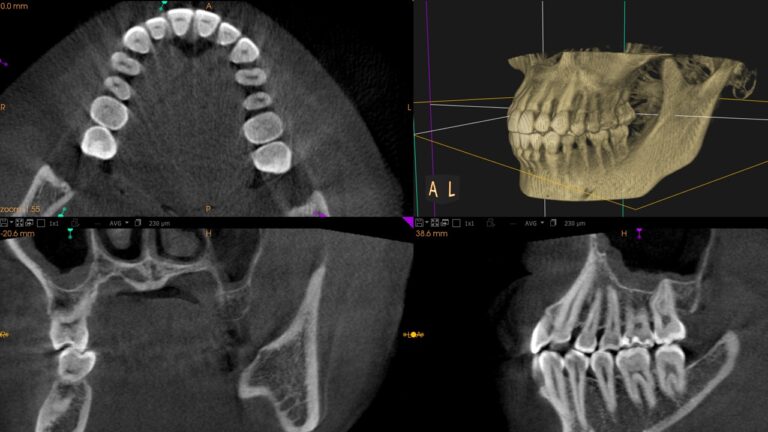 歯科用CT（X-ERA MF）